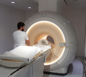 Tumori ereditari: la prevenzione è fondamentale (e ora anche più facile)