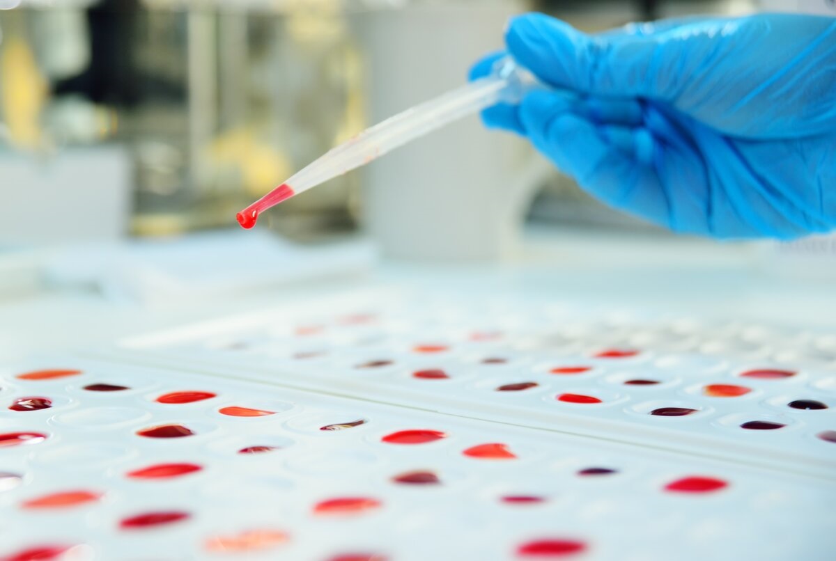 Proteina “Er”: individuato un nuovo gruppo sanguigno
