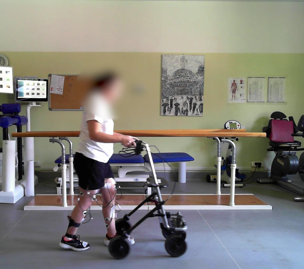 Paralizzata da cinque anni: torna a camminare