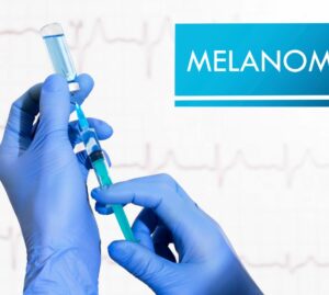 Melanoma: primo vaccino curativo a Napoli