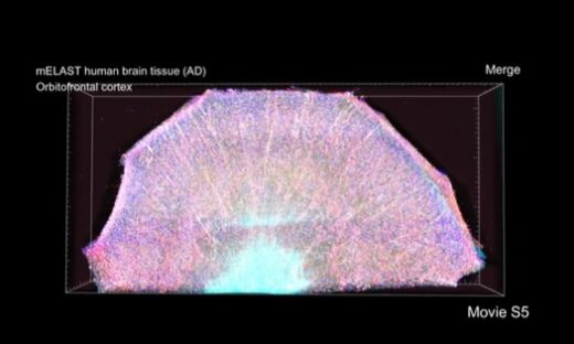 Un viaggio in 3D nel cervello umano