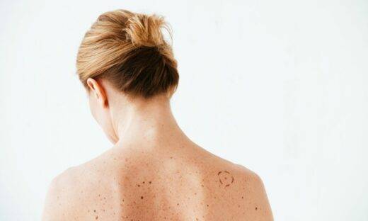 Tumori: una “biopsia virtuale” per scoprire i danni alla pelle