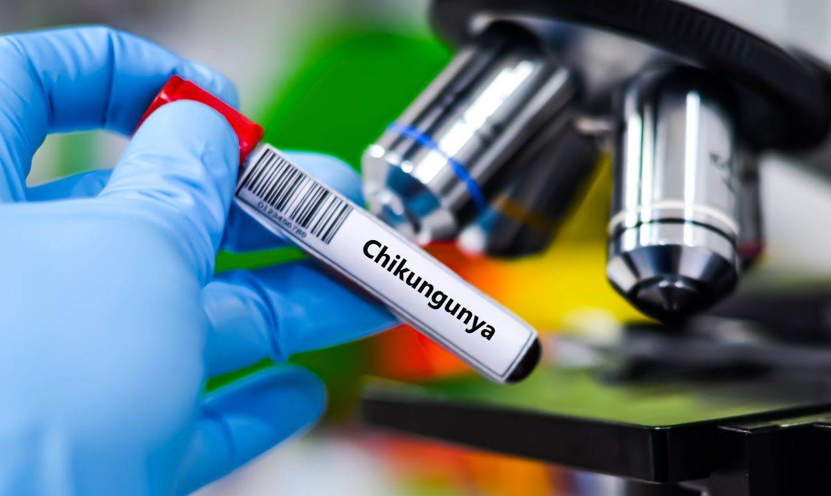 Chikungunya