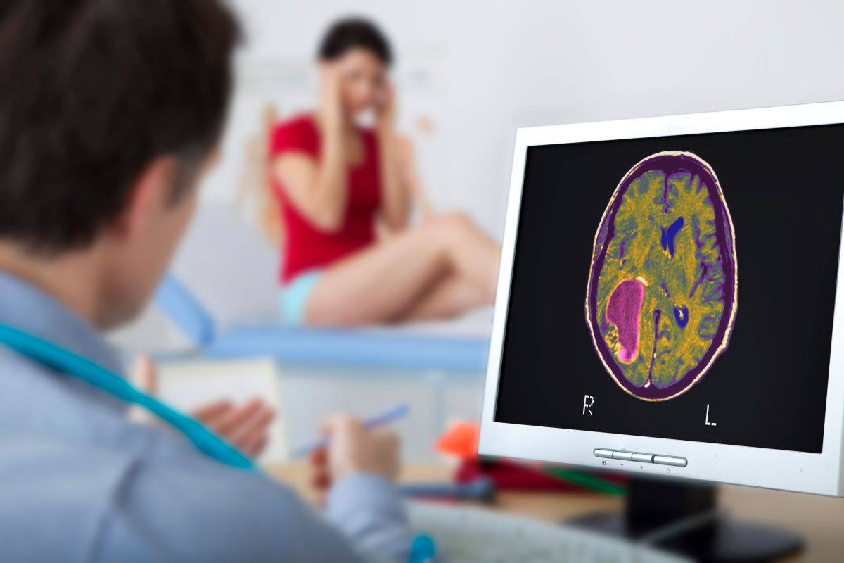 Tumori al cervello: nuove strategie per rallentare il più aggressivo