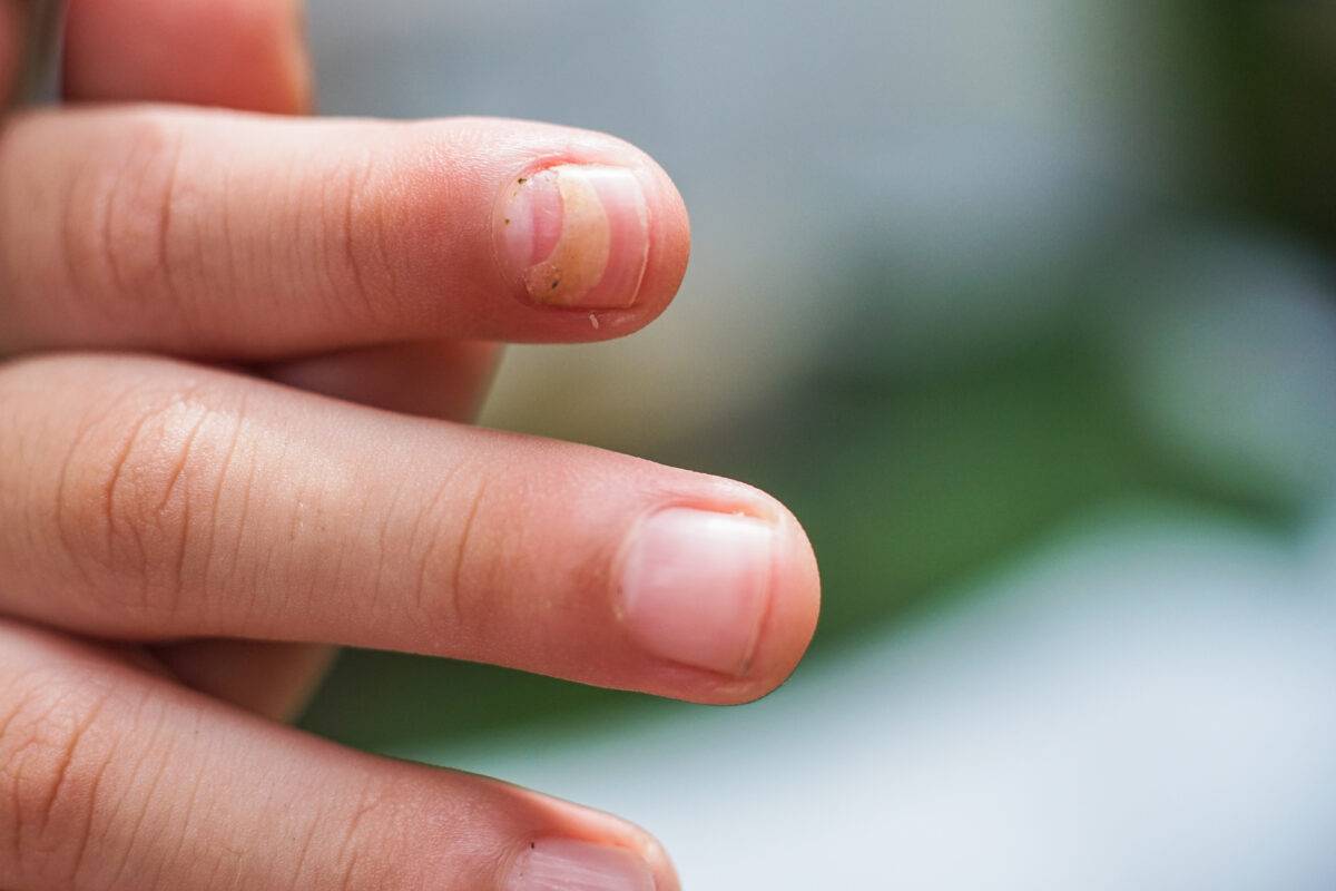 Quanto siamo stressati? Ce lo possono dire le unghie