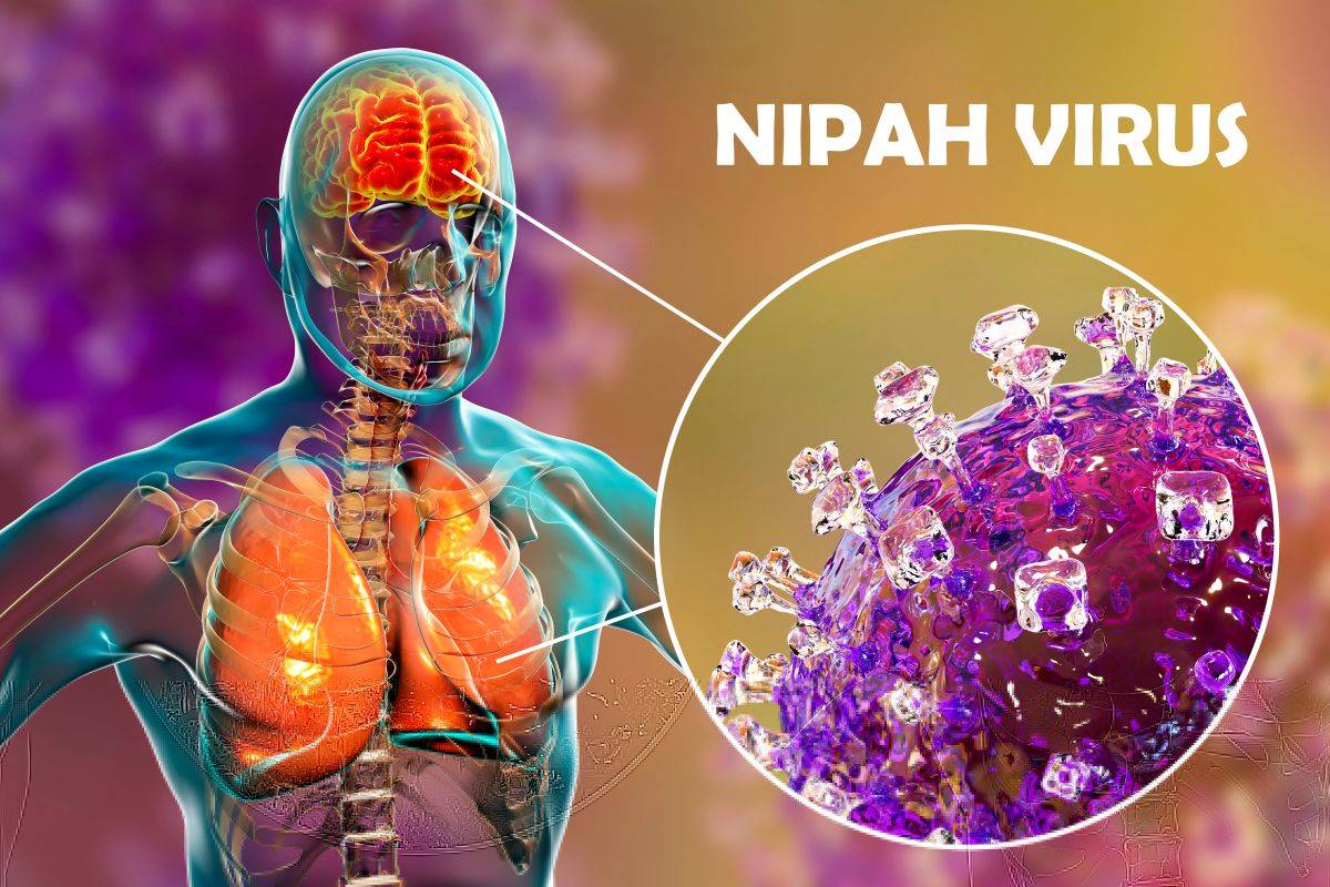 nipah