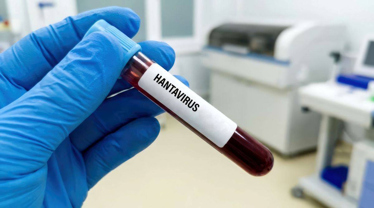 hantavirus